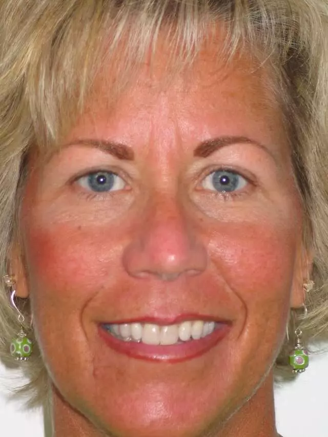 A Permanent Solution: Permanent Cosmetics By Theresa