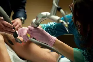 Take It Off Laser Tattoo Removal Louisville KY