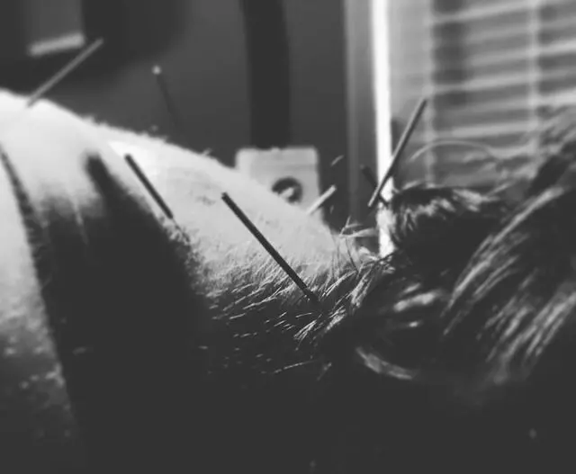 AcuBalance Acupuncture & Integrative Medicine