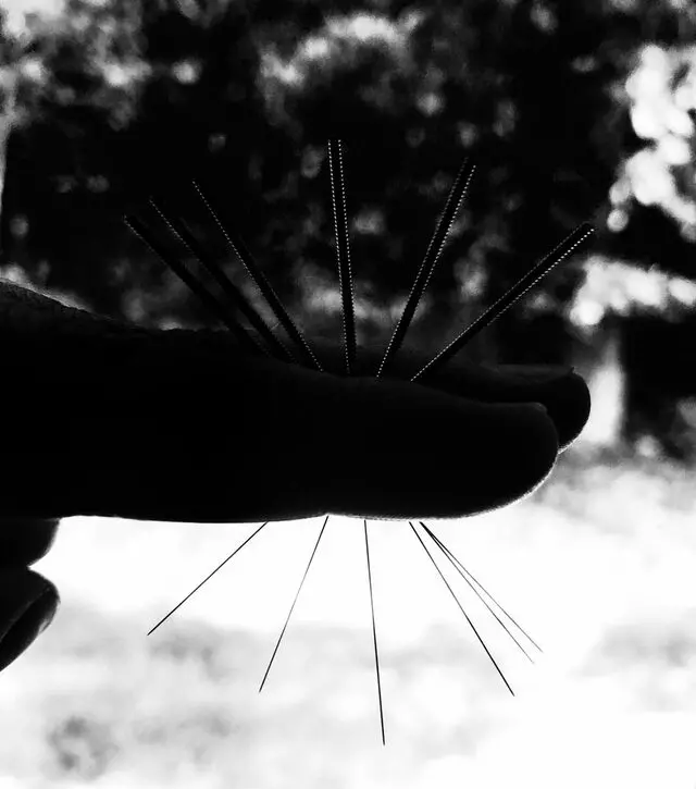 AcuBalance Acupuncture & Integrative Medicine