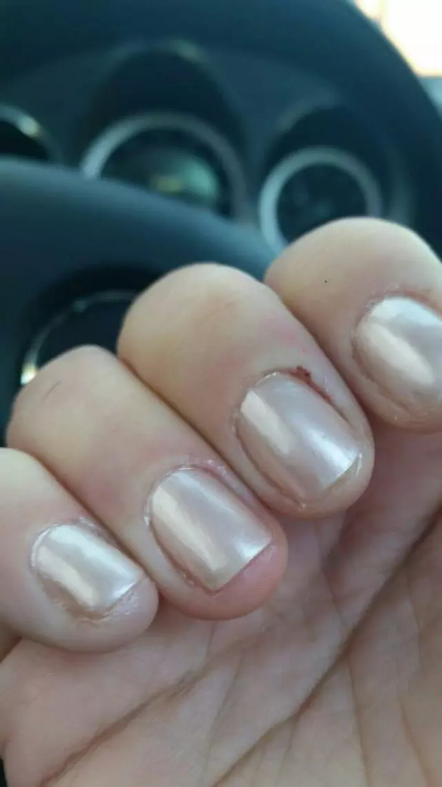 All 4 Nails